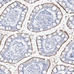 SLC26A3 Antibody in Immunohistochemistry (IHC)