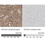 SPPL2A Antibody in Immunohistochemistry (IHC)