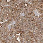 SPPL2A Antibody in Immunohistochemistry (IHC)