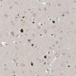 SLC35A2 Antibody in Immunohistochemistry (Paraffin) (IHC (P))