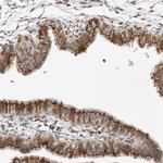 SLC35A2 Antibody in Immunohistochemistry (Paraffin) (IHC (P))