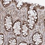 SLC35A2 Antibody in Immunohistochemistry (Paraffin) (IHC (P))