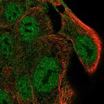 SLC9A4 Antibody in Immunocytochemistry (ICC/IF)