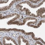 LAGE3 Antibody in Immunohistochemistry (Paraffin) (IHC (P))