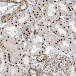 LAGE3 Antibody in Immunohistochemistry (Paraffin) (IHC (P))