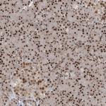 LAGE3 Antibody in Immunohistochemistry (Paraffin) (IHC (P))