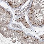 LAGE3 Antibody in Immunohistochemistry (Paraffin) (IHC (P))