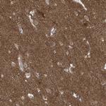 LAGE3 Antibody in Immunohistochemistry (Paraffin) (IHC (P))