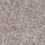 LAGE3 Antibody in Immunohistochemistry (Paraffin) (IHC (P))