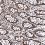 LAGE3 Antibody in Immunohistochemistry (Paraffin) (IHC (P))