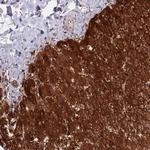 ASNSD1 Antibody in Immunohistochemistry (Paraffin) (IHC (P))