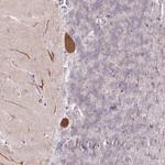 AMTN Antibody in Immunohistochemistry (Paraffin) (IHC (P))