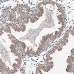 Mgea5 Antibody in Immunohistochemistry (IHC)