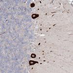 FAM110C Antibody in Immunohistochemistry (Paraffin) (IHC (P))