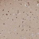 PLCH1 Antibody in Immunohistochemistry (Paraffin) (IHC (P))