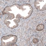 UMPS Antibody in Immunohistochemistry (IHC)