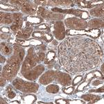 UMPS Antibody in Immunohistochemistry (IHC)