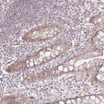 EXOSC7 Antibody in Immunohistochemistry (Paraffin) (IHC (P))