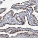 CDS1 Antibody in Immunohistochemistry (IHC)