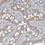 CDS1 Antibody in Immunohistochemistry (IHC)