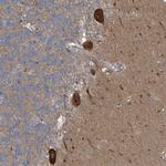 CDS1 Antibody in Immunohistochemistry (IHC)