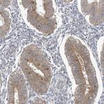 CDS1 Antibody in Immunohistochemistry (IHC)