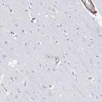 ANKRD23 Antibody in Immunohistochemistry (IHC)