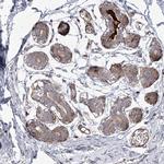 ANKRD23 Antibody in Immunohistochemistry (IHC)