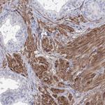 ANKRD23 Antibody in Immunohistochemistry (IHC)