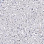 SLC7A7 Antibody in Immunohistochemistry (Paraffin) (IHC (P))