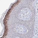 SLC7A7 Antibody in Immunohistochemistry (Paraffin) (IHC (P))