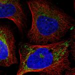 EIF2A Antibody in Immunocytochemistry (ICC/IF)