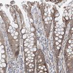 EIF2A Antibody in Immunohistochemistry (Paraffin) (IHC (P))