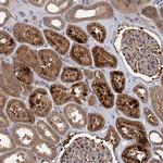 SEPP1 Antibody in Immunohistochemistry (IHC)