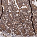 SEPP1 Antibody in Immunohistochemistry (IHC)