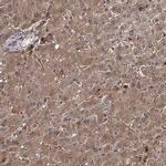 SEPP1 Antibody in Immunohistochemistry (IHC)