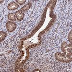 GNL3L Antibody in Immunohistochemistry (Paraffin) (IHC (P))