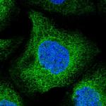 UBXD2 Antibody in Immunocytochemistry (ICC/IF)