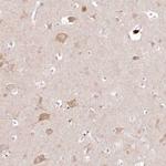 ARFGEF3 Antibody in Immunohistochemistry (Paraffin) (IHC (P))