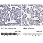 DNAH6 Antibody in Immunohistochemistry (IHC)