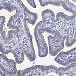 DNAH6 Antibody in Immunohistochemistry (IHC)