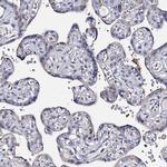 DNAH6 Antibody in Immunohistochemistry (IHC)