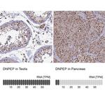 DNPEP Antibody in Immunohistochemistry (IHC)