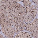 DNPEP Antibody in Immunohistochemistry (IHC)