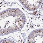 DNPEP Antibody in Immunohistochemistry (IHC)