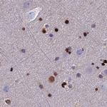 DNPEP Antibody in Immunohistochemistry (IHC)