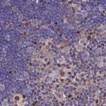 DNPEP Antibody in Immunohistochemistry (IHC)