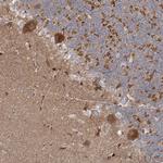 OBSL1 Antibody in Immunohistochemistry (Paraffin) (IHC (P))