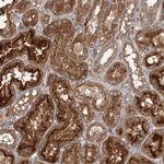 OBSL1 Antibody in Immunohistochemistry (Paraffin) (IHC (P))