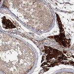 OBSL1 Antibody in Immunohistochemistry (Paraffin) (IHC (P))